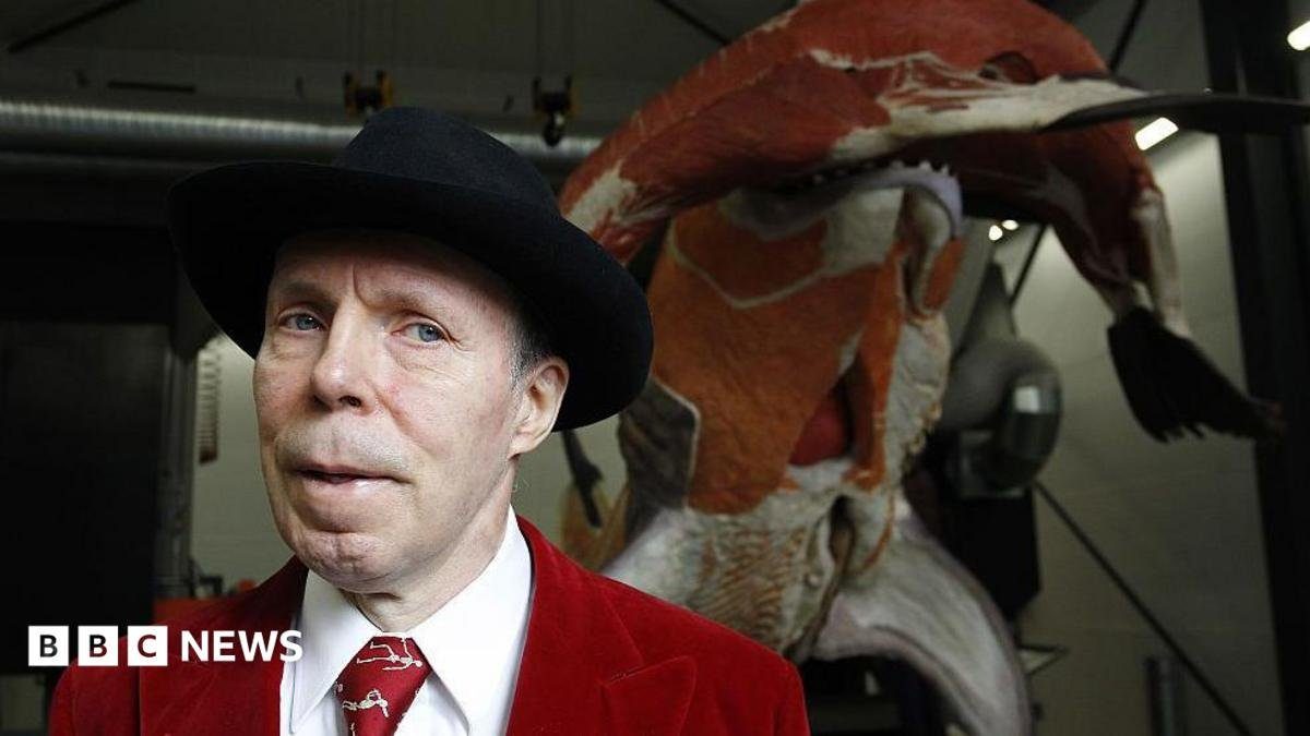 Gunther von Hagens, Body Worlds creator, dies at 81